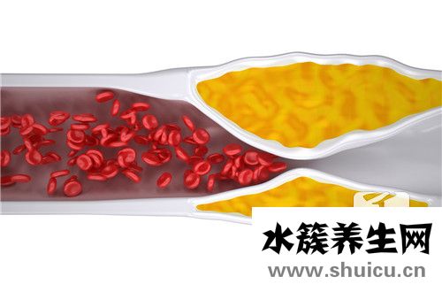 如何降低甘油三酯