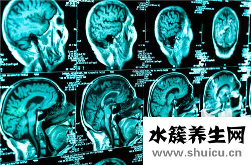 膠質(zhì)瘤能活多久