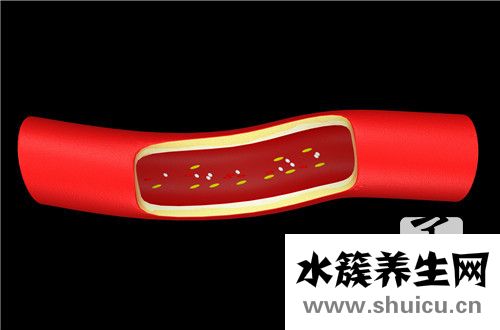 主動(dòng)脈鈣化