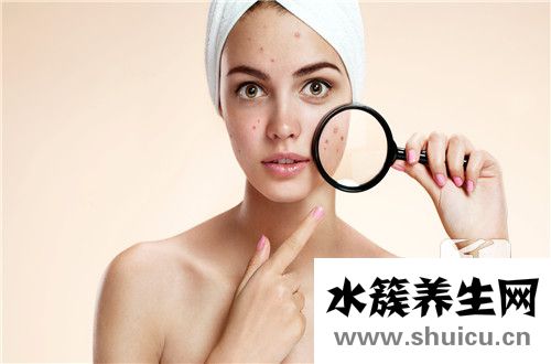 夫西地酸乳膏治痘痘