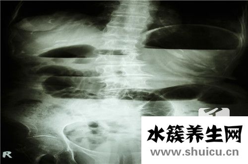 做完胃鏡后注意事項(xiàng)