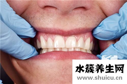 甲硝唑片治牙周炎