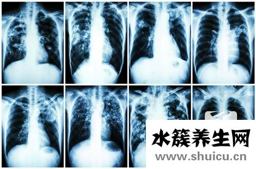 肺部有陰影怎么回事