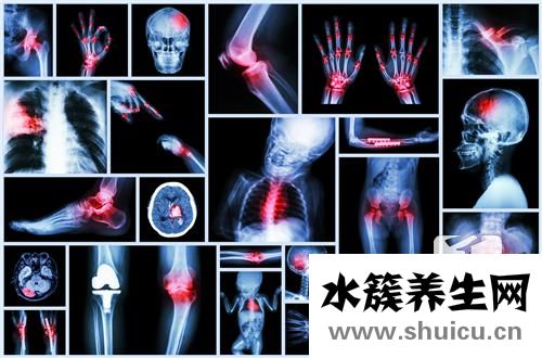 橈骨遠(yuǎn)端骨折