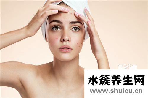 臉上長痘是什么原因