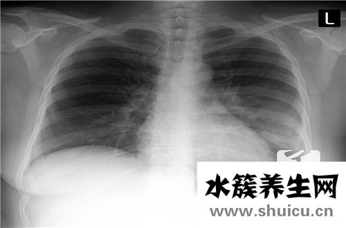 創(chuàng)傷骨科