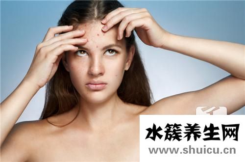 臉上長痘是什么原因