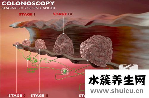 術(shù)后復(fù)發(fā)