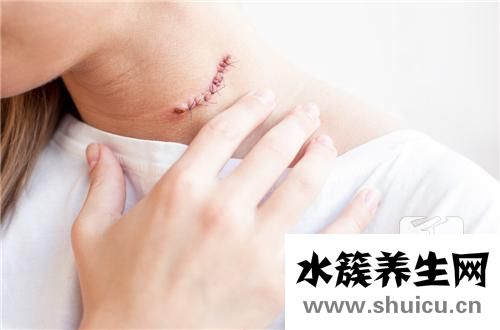 淋巴細胞數偏低