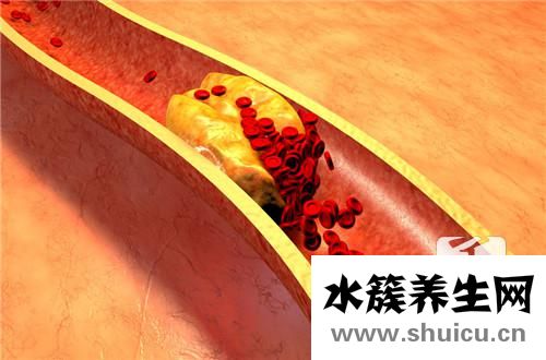 視黃醇結合蛋白偏低