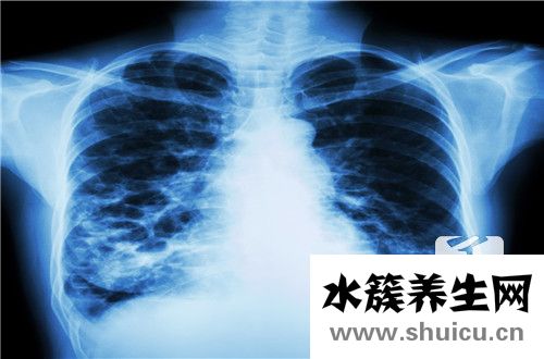 肺結節吃什么好