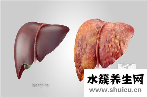 肝囊腫是怎么形成的