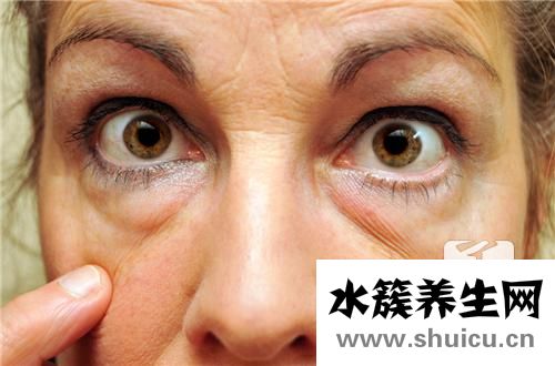 眼袋切除術(shù)