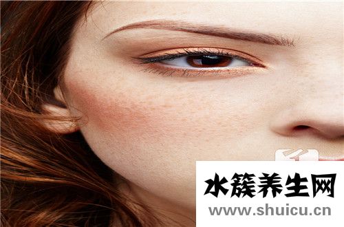 激光祛斑注意事項