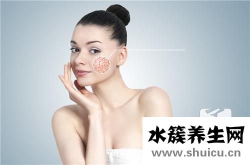 溢脂性皮炎的癥狀