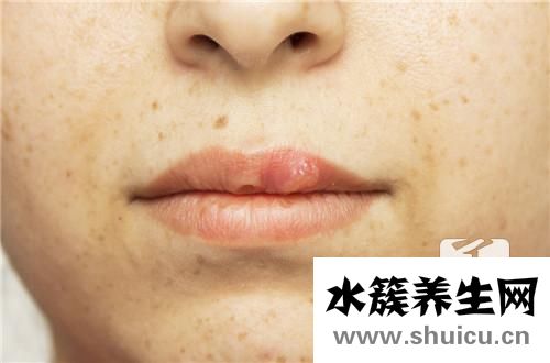 全身皮膚干燥怎么辦