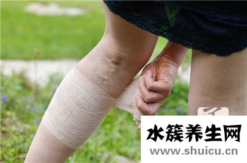 靜脈曲張彈力襪