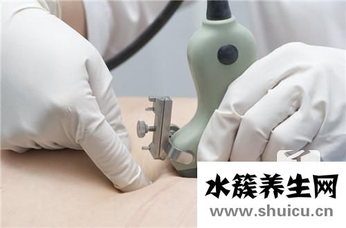 羊水穿刺多久出結果