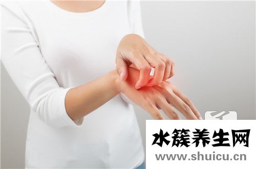 脂溢性皮炎能治好嗎