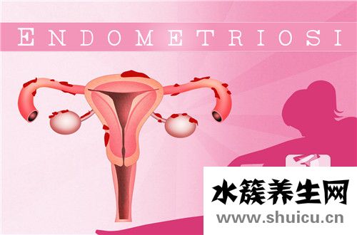 宮頸炎最佳治療方法