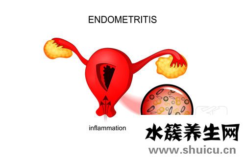 宮頸炎最佳治療方法