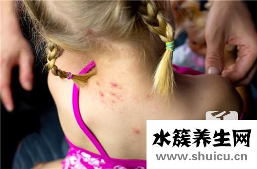 身上起小紅點很癢