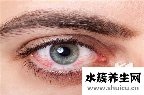 眼結石怎么治療