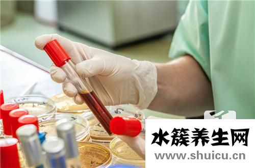 血常規(guī)血白細胞偏高