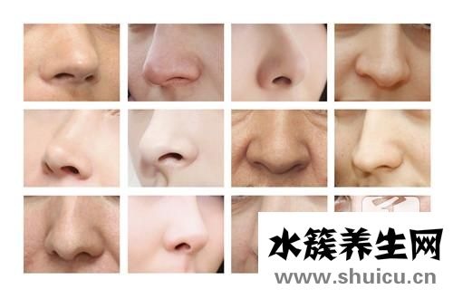 鼻竇炎怎么治療