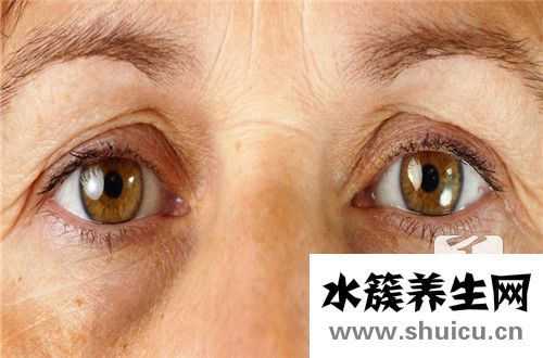 眼睛干澀是怎么回事