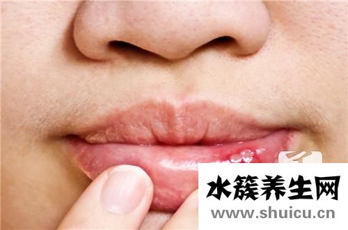 潰瘍的白色刮掉會怎樣