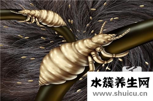 頭發(fā)上長虱子怎么辦