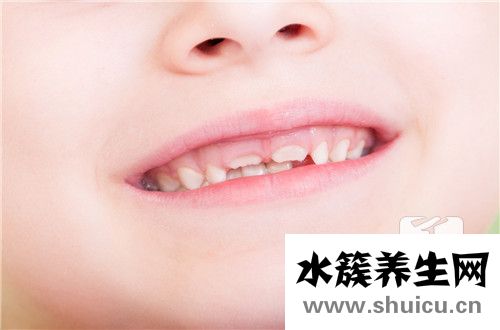 乳牙沒掉又長新牙怎么辦