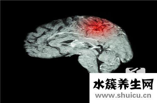 胎兒側腦室正常值