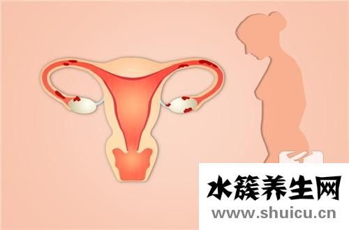 子宮腺肌癥最新治療