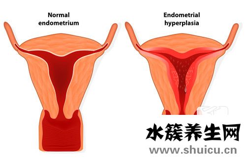 內膜回聲欠均勻