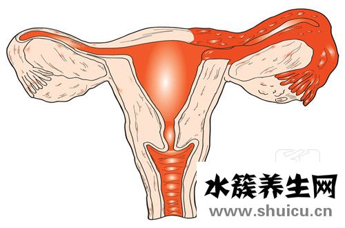 多囊促排卵懷孕率高嗎