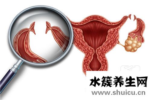 造影能把輸卵管通開嗎