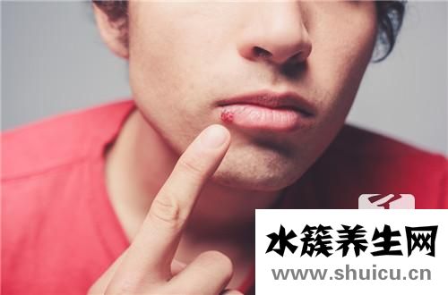 帶狀皰疹后續治療