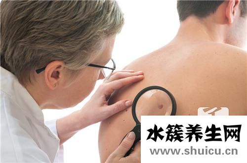 激光點痣正常恢復過程