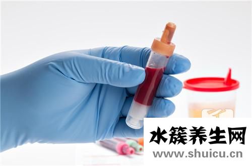 尿檢白細(xì)胞高是回事