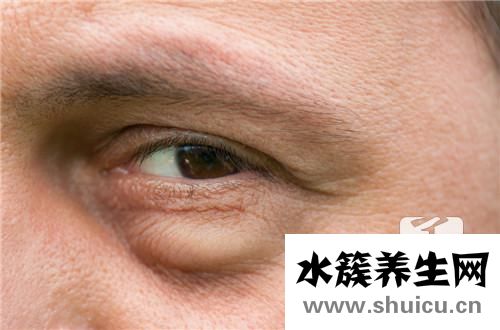 臉上小包不痛不癢凸起