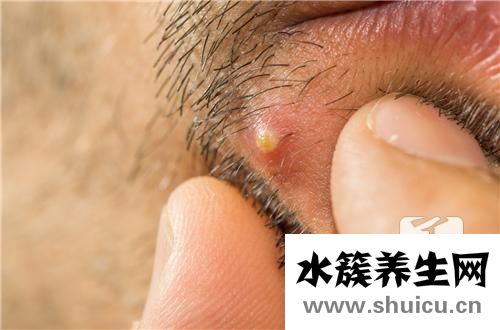 臉上小包不痛不癢凸起