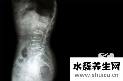 一味草藥治好骨質增生