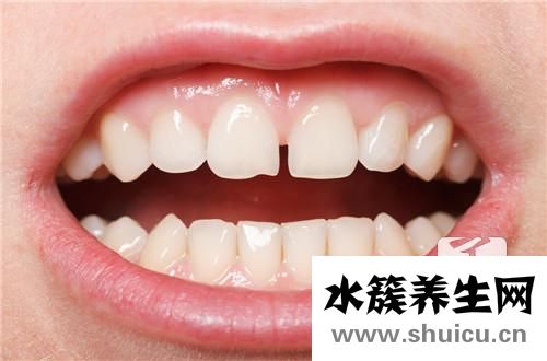 牙齒敏感疼痛辦