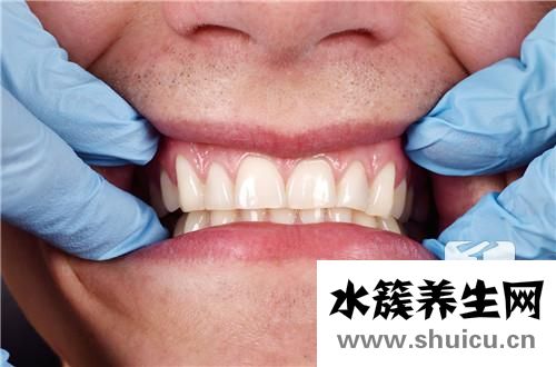 牙釉質脫落早期同