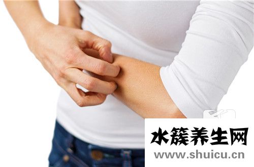 先天性血管畸形