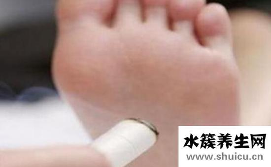 根治腳氣的偏方