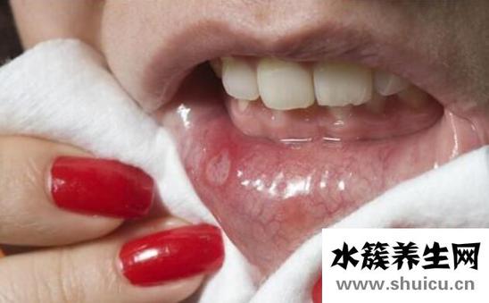 經常口腔潰瘍是什么原因