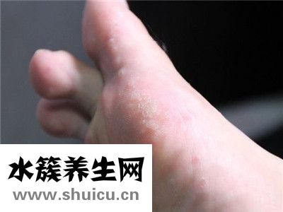 腳氣產生的原因